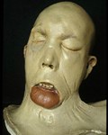 The Skull of John Brogan